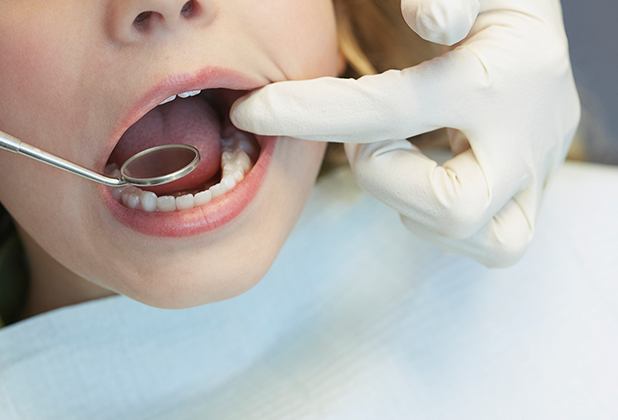 Dentist checking child's new tooth colored filling