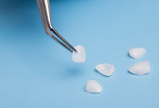 Pair of tweezers holding veneers in Beverly Hills