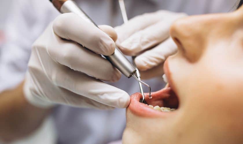 Why Is Tooth Extraction Necessary?