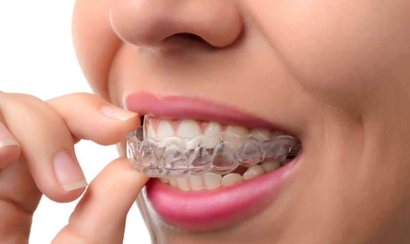 Transform Your Teeth with Invisalign Treatment