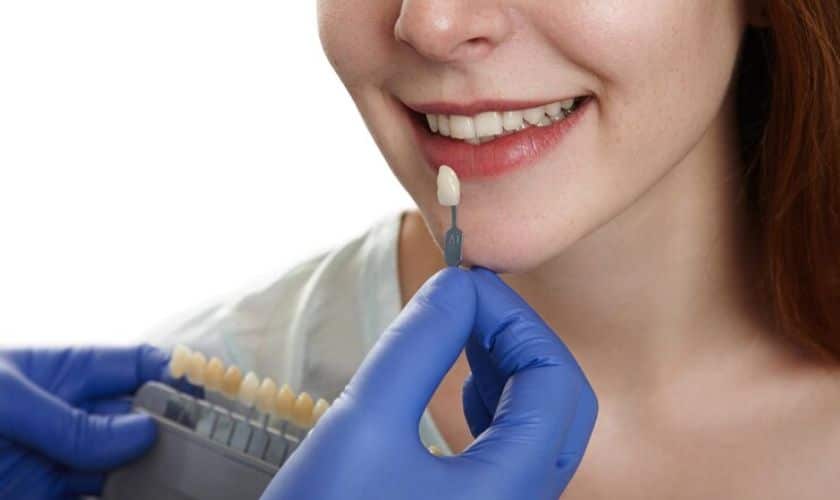 Transform Your Teeth With Dental Veneers