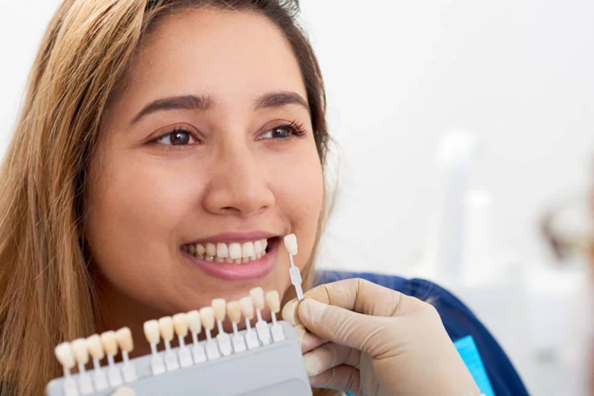 The Role of Dental Veneers Before and After: Real Smiles Makeover