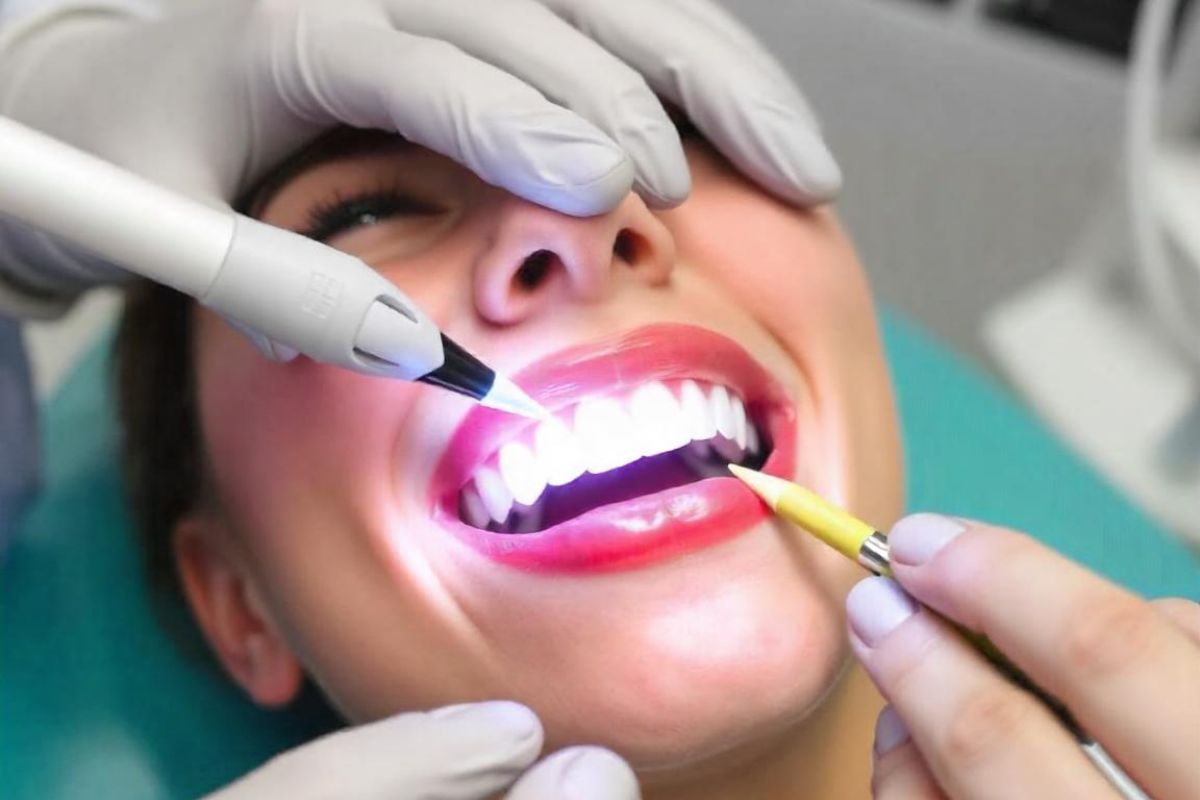 What is The Most Effective Teeth Whitening Method?
