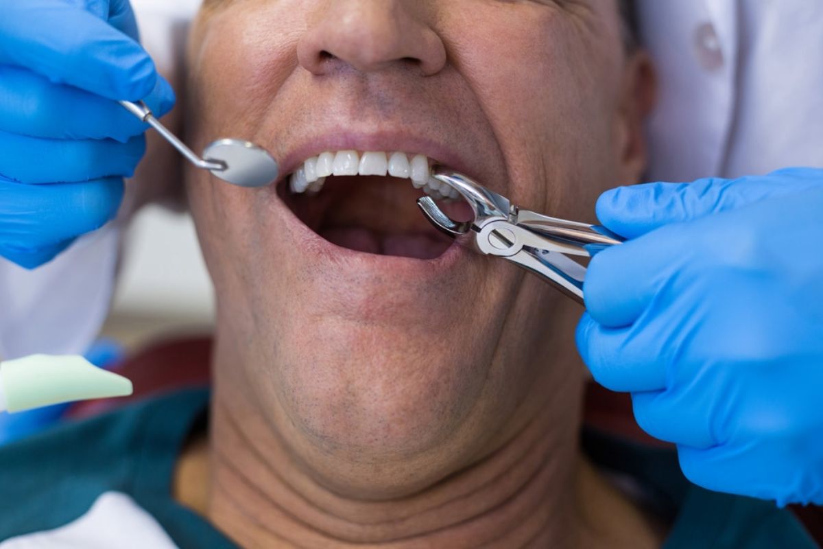 How Emergency Dentists Handle Tooth Extractions Quickly & Safely?