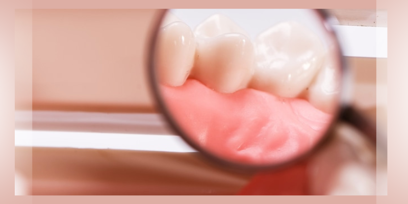 Are Bleeding Gums A Sign Of Something Serious?