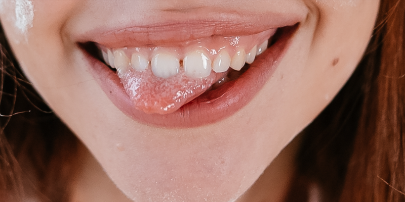 Why Are My Teeth Appearing Clear at the Bottom?