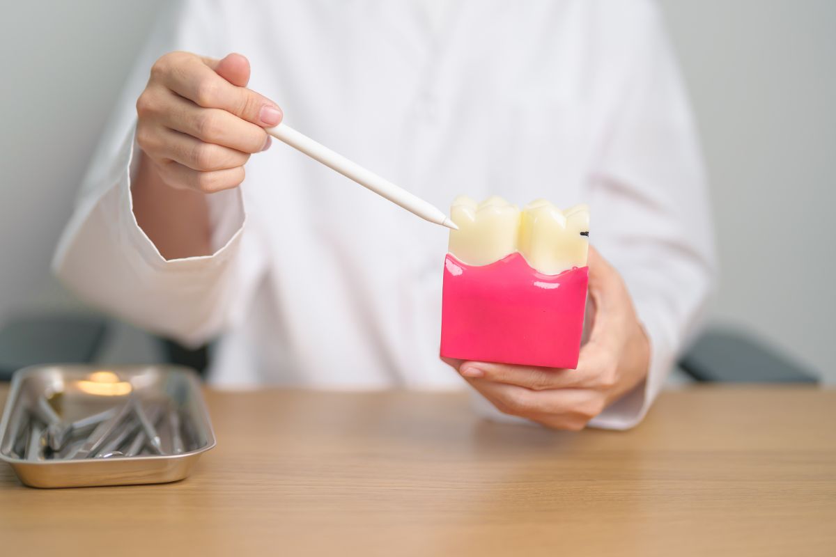 Understanding the Connection Between Tooth Decay and Gum Disease