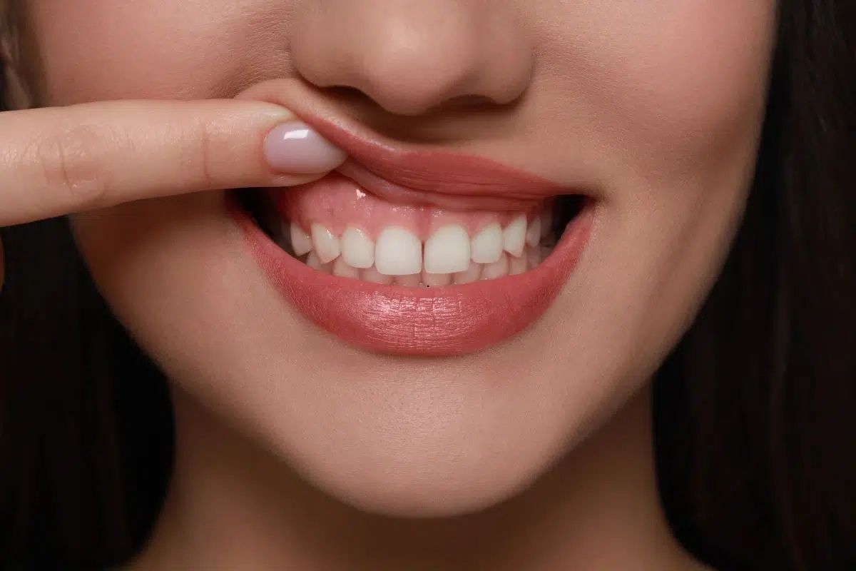 Plaque vs Tartar: Understanding the Difference and Why It Matters